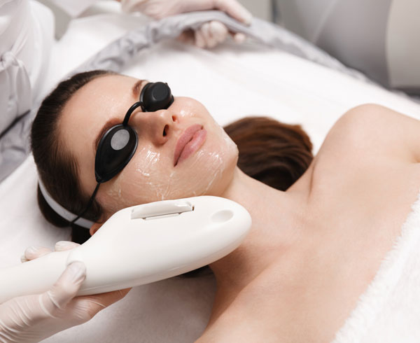 Photofacials